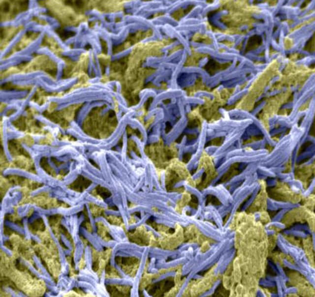 bacteria growing on colon tumors
